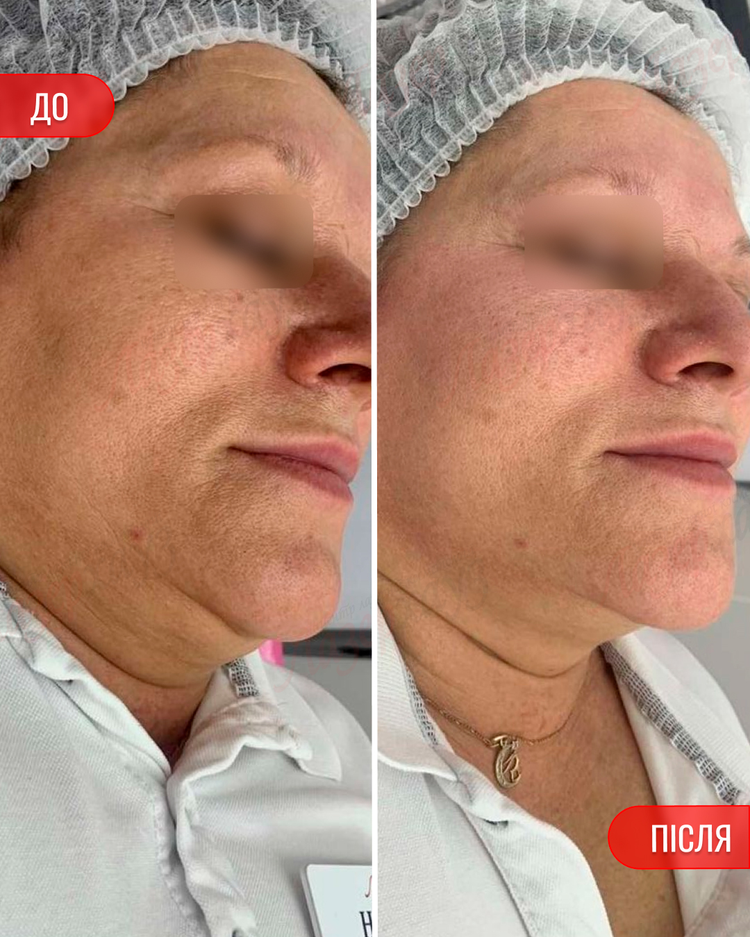 До і після — обличчя
